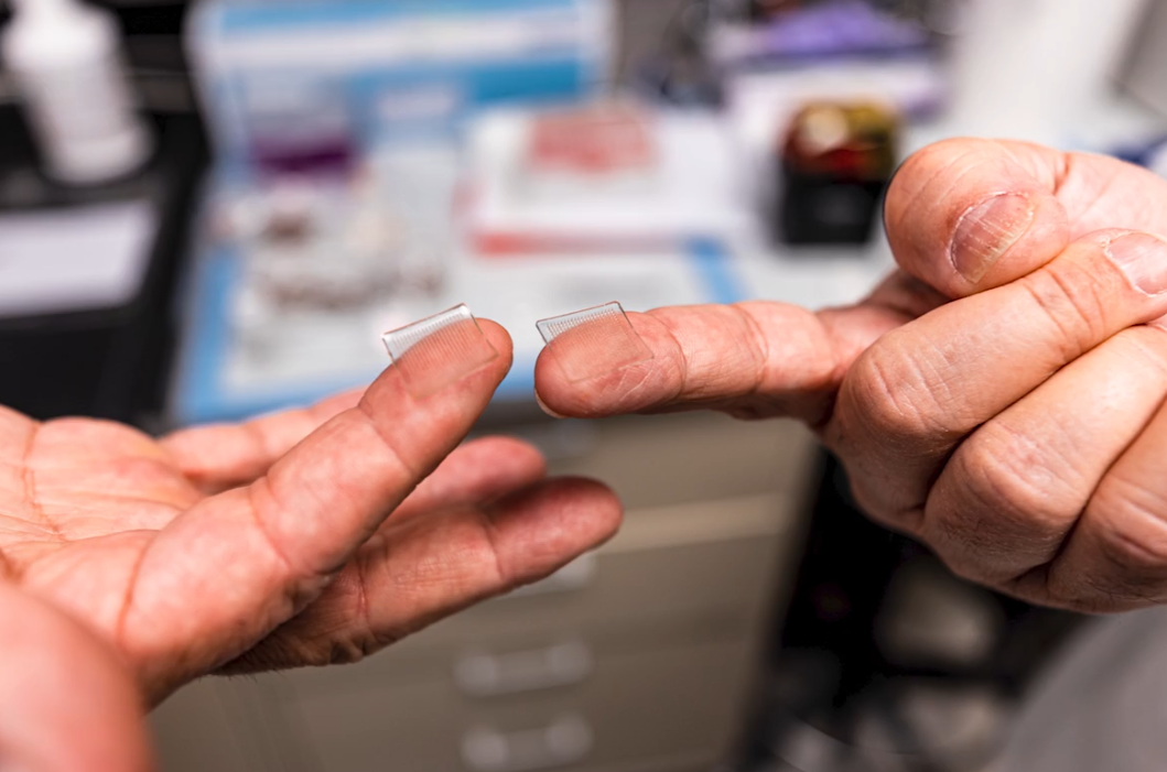 micro-needle array